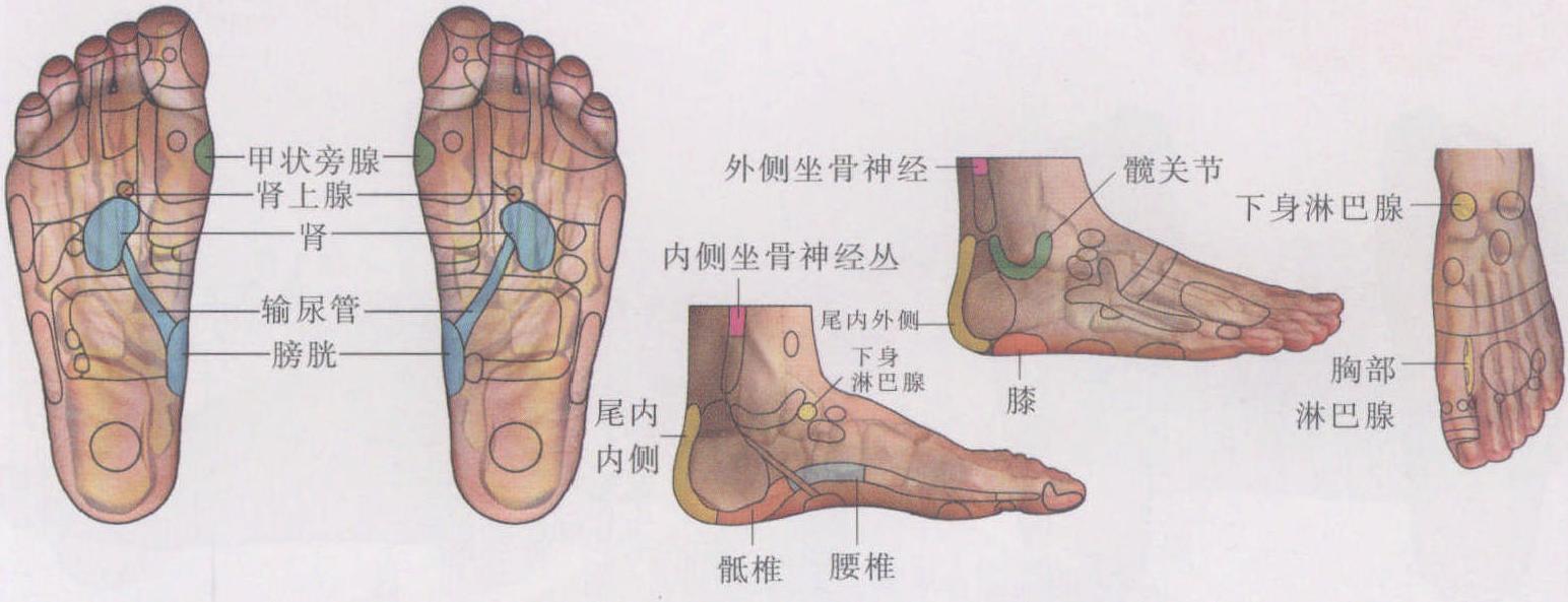 坐骨神經(jīng)痛
